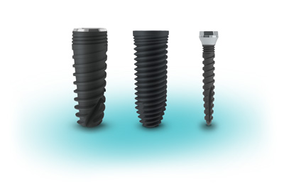 implantes dentales